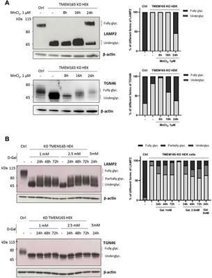 Differential Effects of D-Galactose Supplementation on Golgi Glycosylation Defects in TMEM165 Deficiency